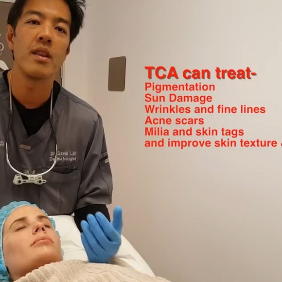 TCA Peel 15%_1oz Wrinkles, Age Spots, Crepey Skin - Picture 6 of 6